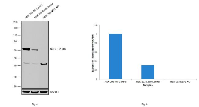 NEFL Antibody in Western Blot (WB)