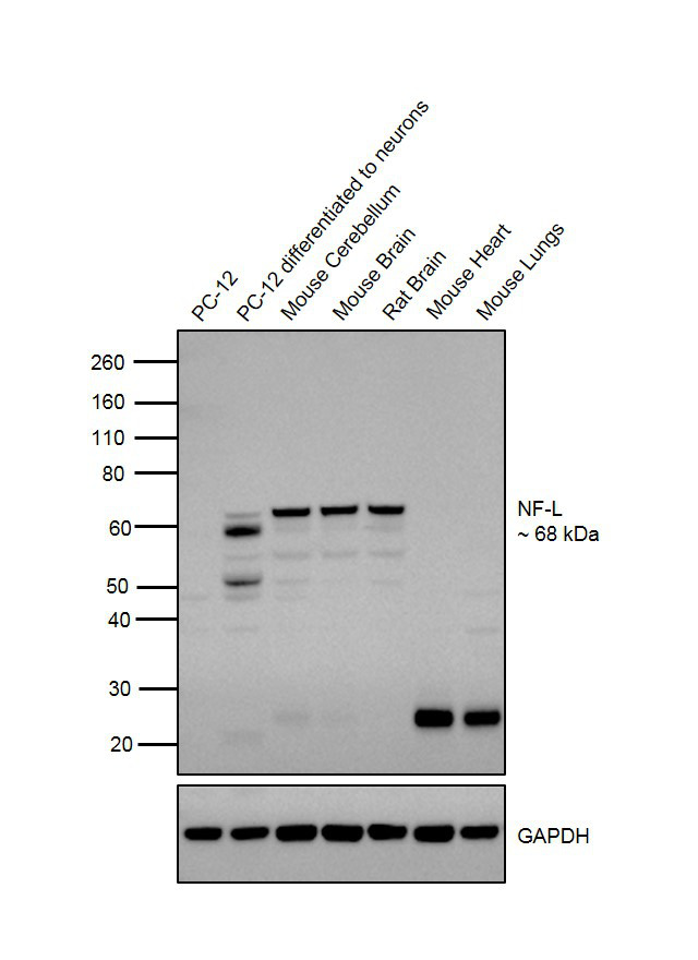 NEFL Antibody