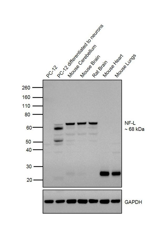 NEFL Antibody in Western Blot (WB)