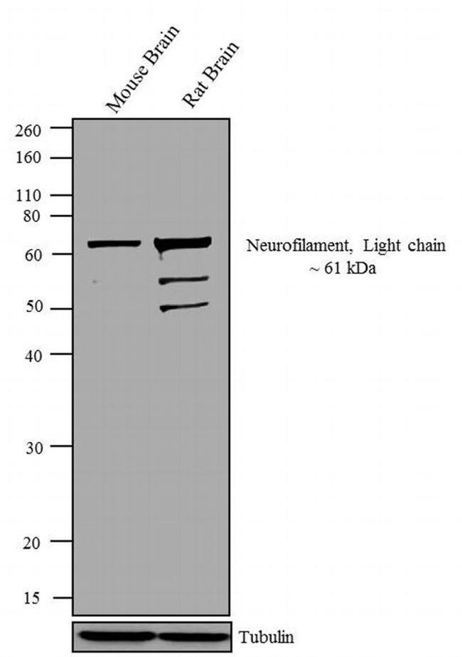 NEFL Antibody in Western Blot (WB)