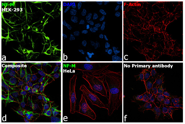 NEFM Antibody in Immunocytochemistry (ICC/IF)