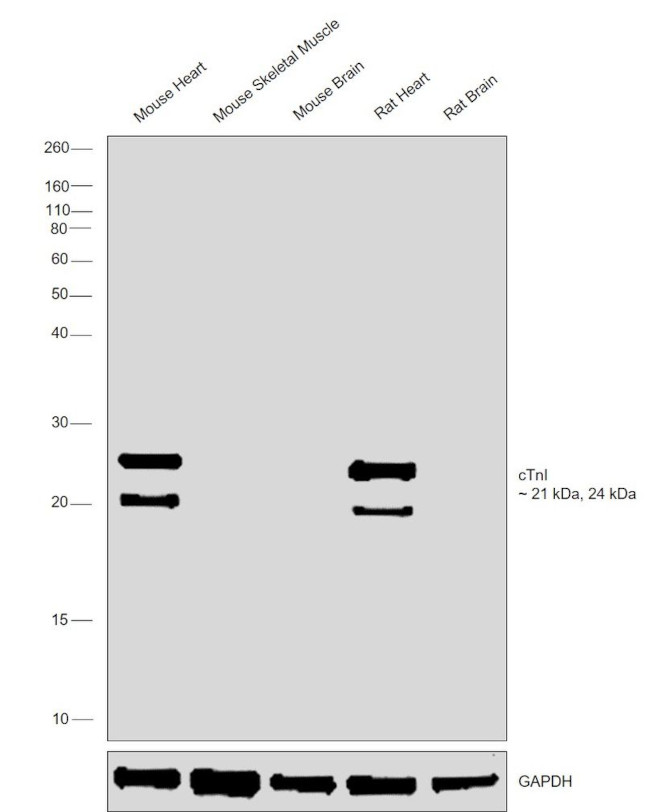 Cardiac Troponin I Antibody