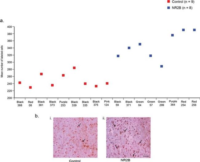 NMDAR2B Antibody in Immunohistochemistry (IHC)