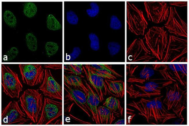 Phospho-ATM (Ser1981) Antibody in Immunocytochemistry (ICC/IF)