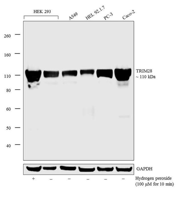 TRIM28 Antibody in Western Blot (WB)