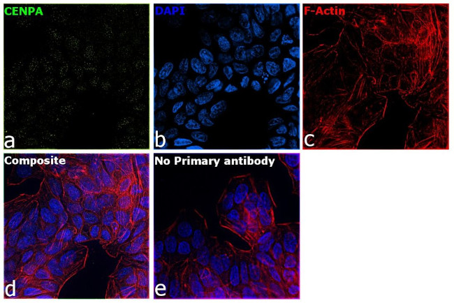 CENPA Antibody in Immunocytochemistry (ICC/IF)