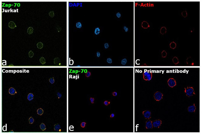 Zap-70 Antibody in Immunocytochemistry (ICC/IF)