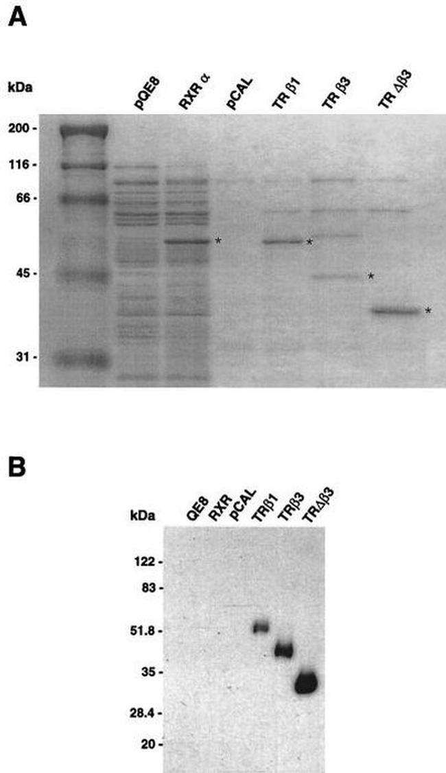 THRA/THRB Antibody in Western Blot (WB)