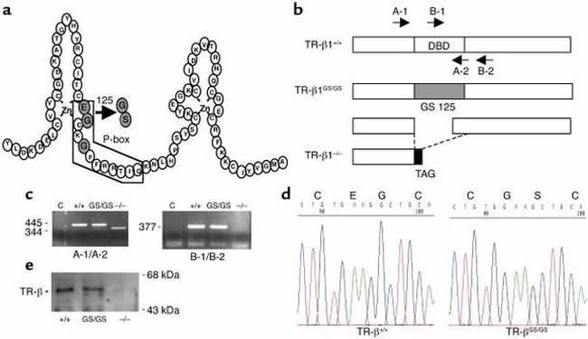 THRA/THRB Antibody in Western Blot (WB)