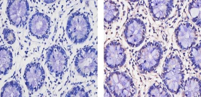 THRA/THRB Antibody in Immunohistochemistry (Paraffin) (IHC (P))