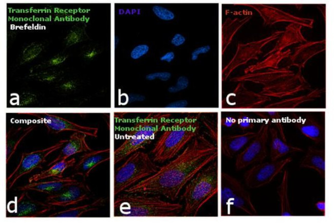 Transferrin Receptor Antibody in Immunocytochemistry (ICC/IF)