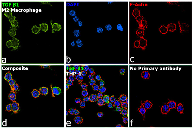 TGF beta-1 Antibody