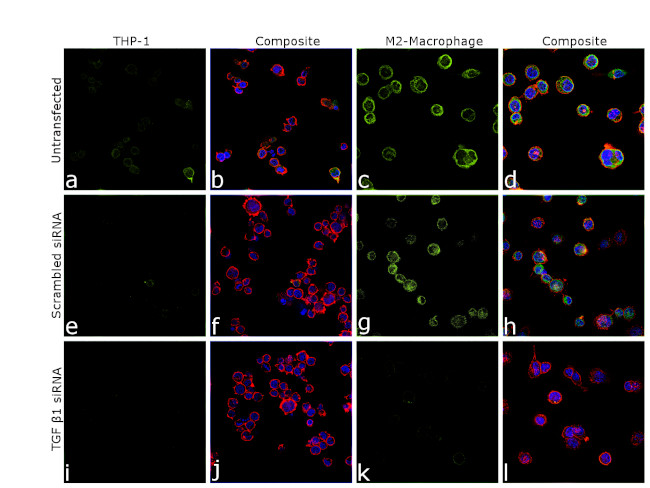 TGF beta-1 Antibody