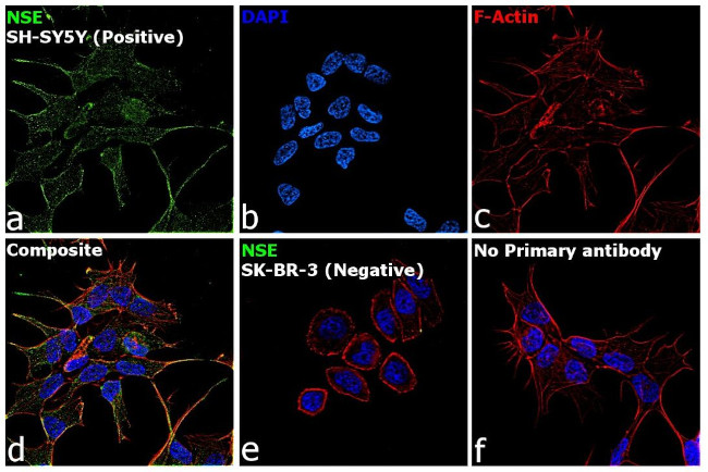 NSE Antibody in Immunocytochemistry (ICC/IF)