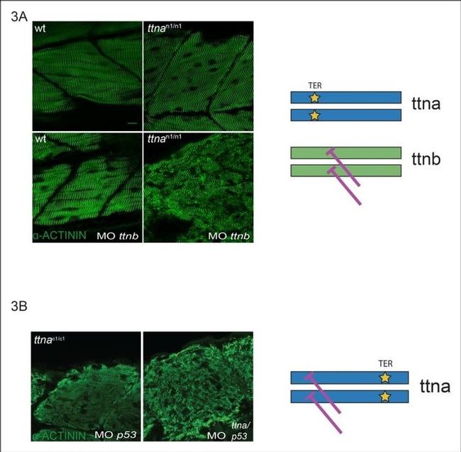 Sarcomeric alpha Actinin Antibody in Immunohistochemistry (IHC)