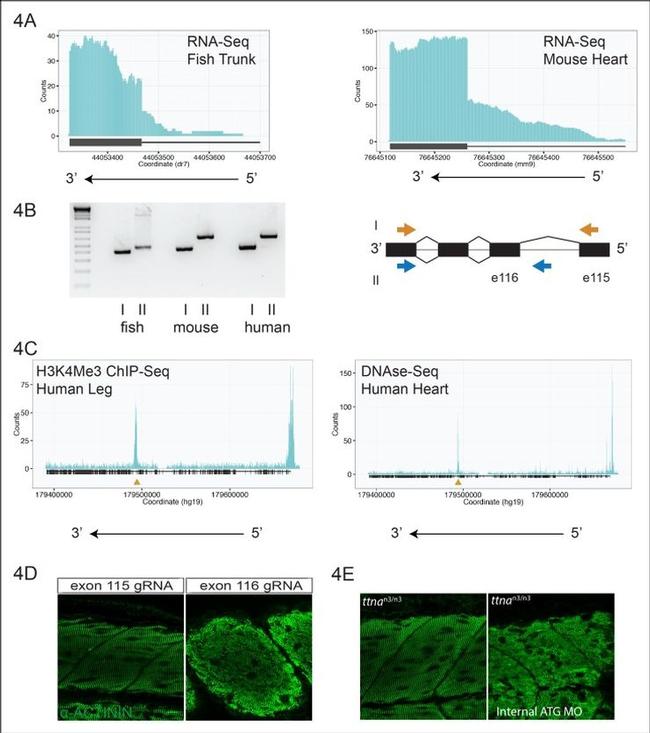 Sarcomeric alpha Actinin Antibody in Immunohistochemistry (IHC)