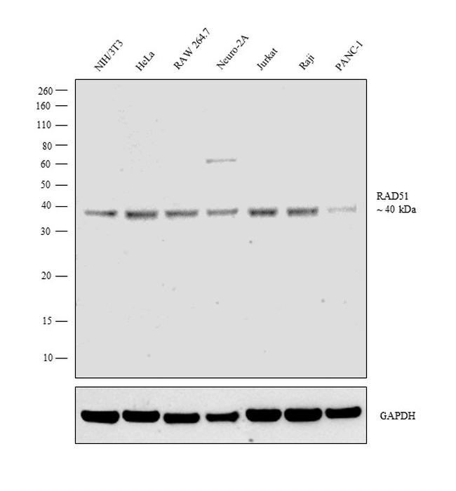 RAD51 Antibody in Western Blot (WB)