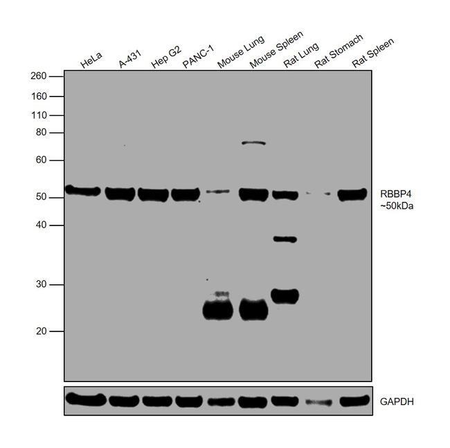 RbAp48 Antibody in Western Blot (WB)