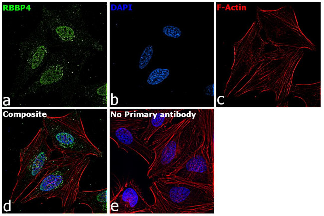 RbAp48 Antibody in Immunocytochemistry (ICC/IF)