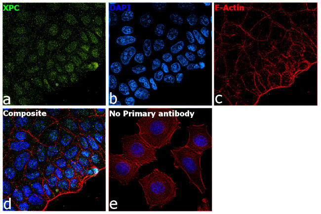 XPC Antibody in Immunocytochemistry (ICC/IF)