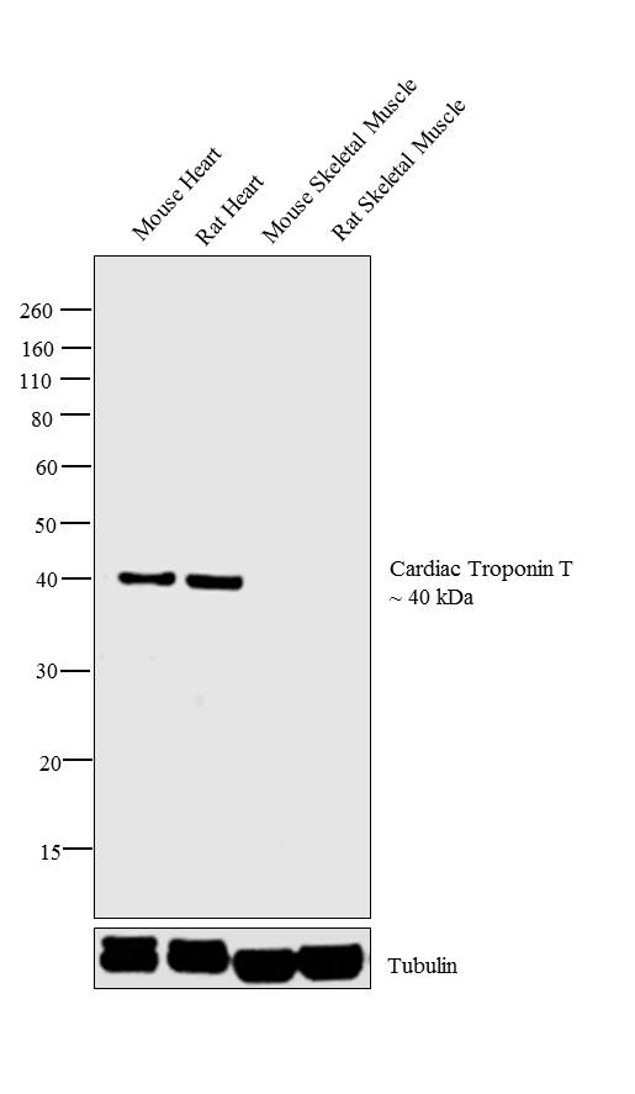 Cardiac Troponin T Antibody