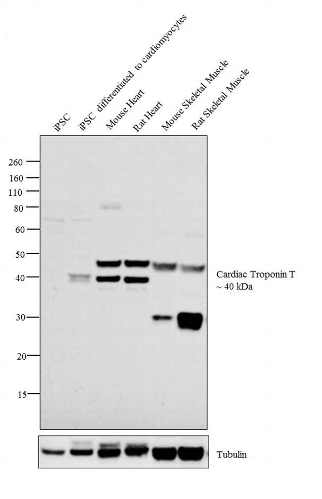 Cardiac Troponin T Antibody