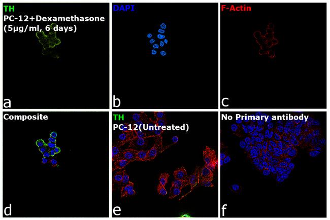 Tyrosine Hydroxylase Antibody