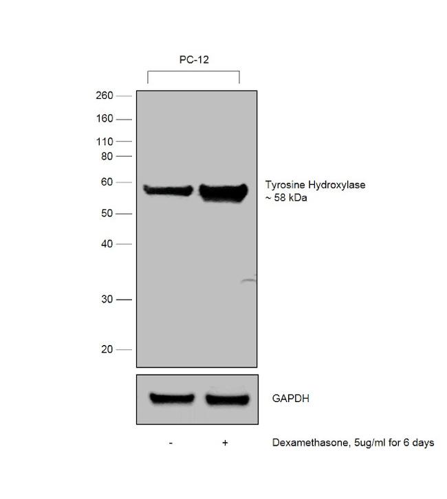 Tyrosine Hydroxylase Antibody