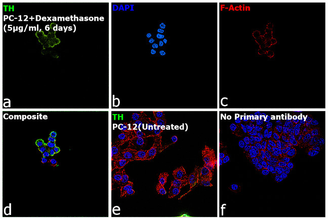 Tyrosine Hydroxylase Antibody in Immunocytochemistry (ICC/IF)