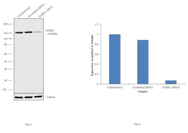 DAPK1 Antibody in Western Blot (WB)