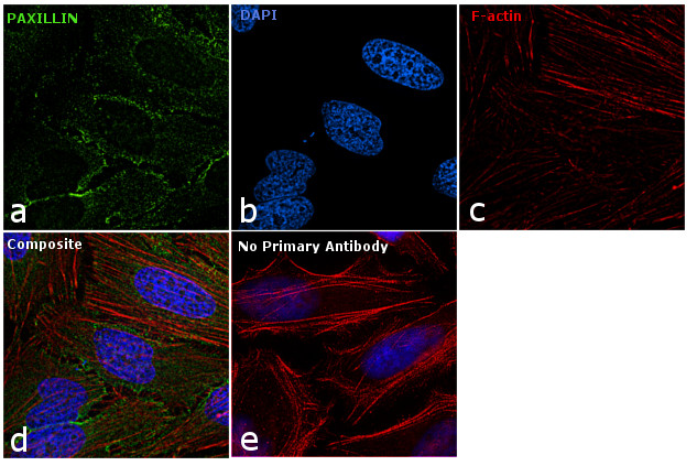 Paxillin Antibody in Immunocytochemistry (ICC/IF)