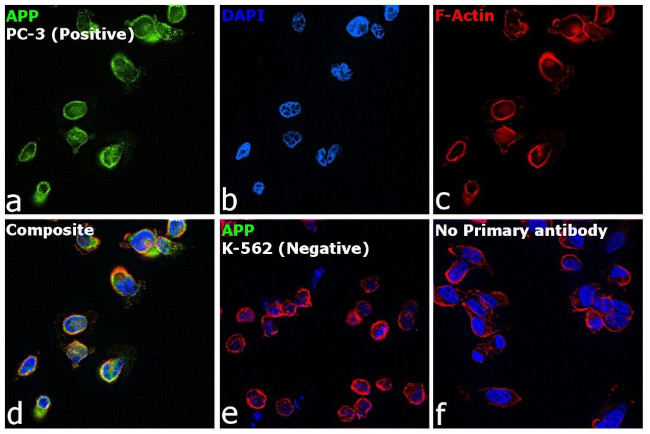 beta Amyloid Antibody