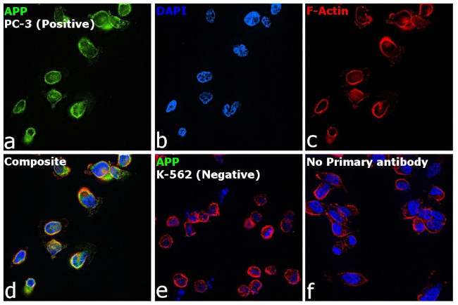 beta Amyloid Antibody in Immunocytochemistry (ICC/IF)