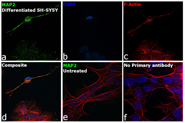 MAP2 Antibody in Immunocytochemistry (ICC/IF)