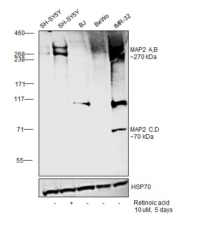 MAP2 Antibody