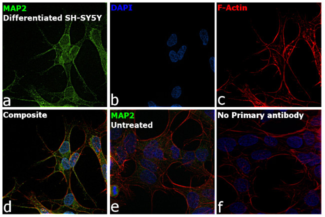 MAP2 Antibody in Immunocytochemistry (ICC/IF)