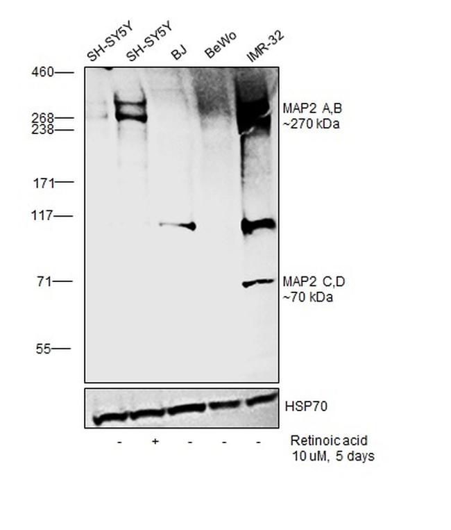 MAP2 Antibody in Western Blot (WB)