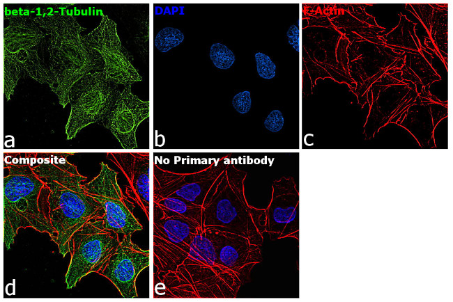 beta Tubulin 1,2 Antibody in Immunocytochemistry (ICC/IF)