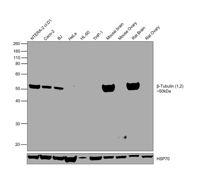 beta Tubulin 1,2 Antibody in Western Blot (WB)