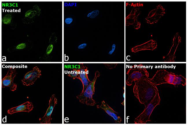 Glucocorticoid Receptor Antibody