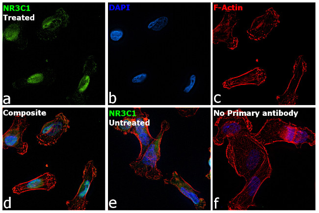 Glucocorticoid Receptor Antibody in Immunocytochemistry (ICC/IF)