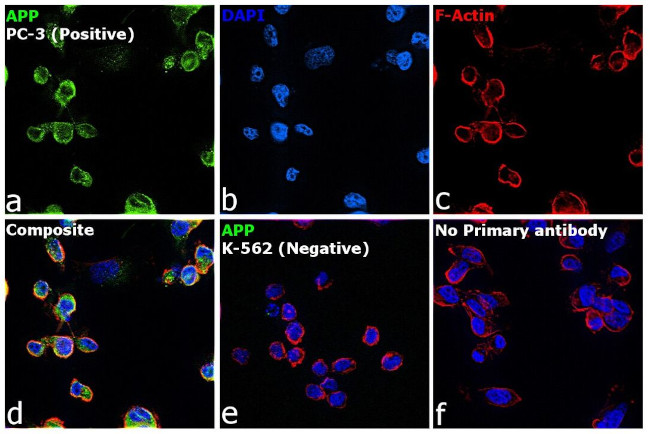 beta Amyloid Antibody