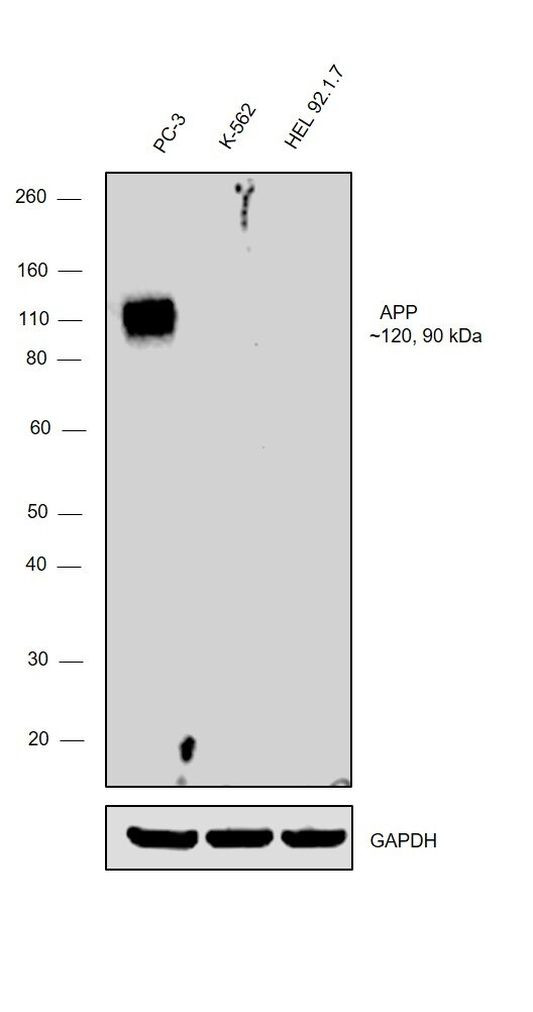 beta Amyloid Antibody