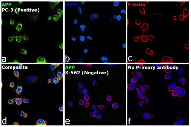 beta Amyloid Antibody in Immunocytochemistry (ICC/IF)