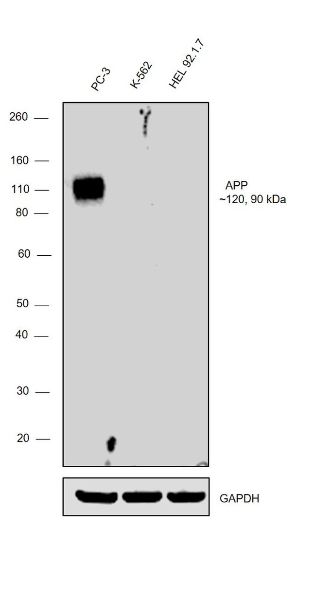 beta Amyloid Antibody in Western Blot (WB)