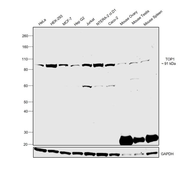 TOP1 Antibody in Western Blot (WB)