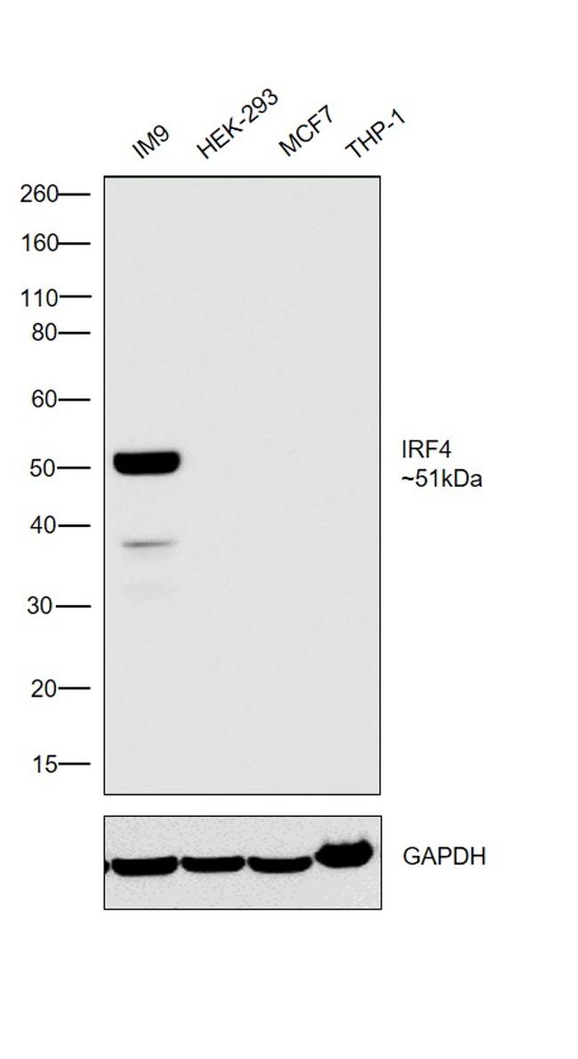 IRF4 Antibody in Western Blot (WB)