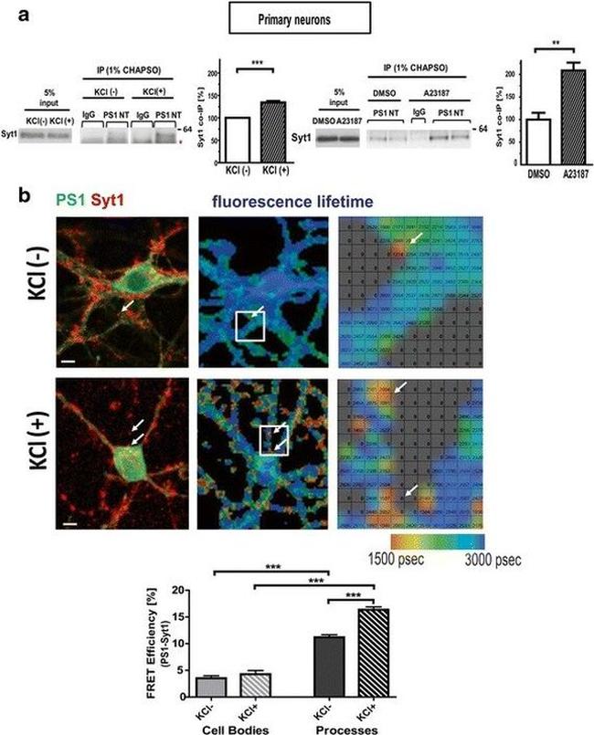 Synaptotagmin 1 Antibody in Immunocytochemistry, Fluorescence Resonance Energy Transfer (ICC/IF, FRET)