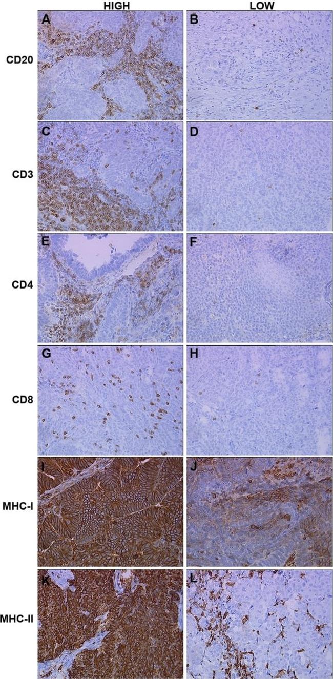 HLA-DR/DP/DQ Antibody in Immunohistochemistry (IHC)