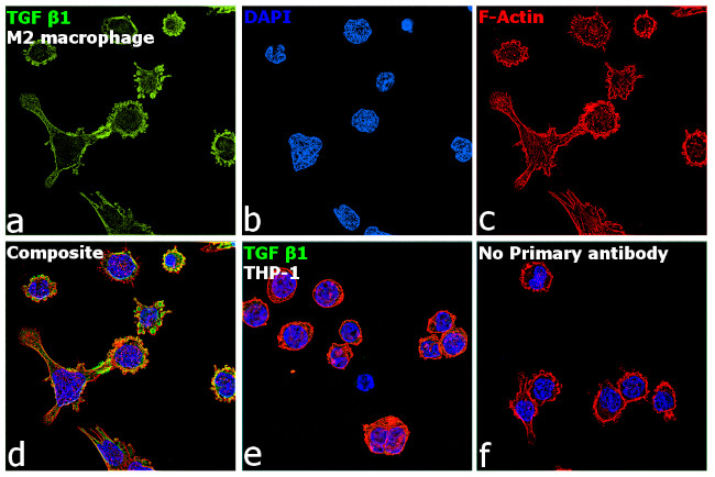 TGF beta-1 Antibody in Immunocytochemistry (ICC/IF)